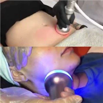 Meaisín Slimming Cryotherapy