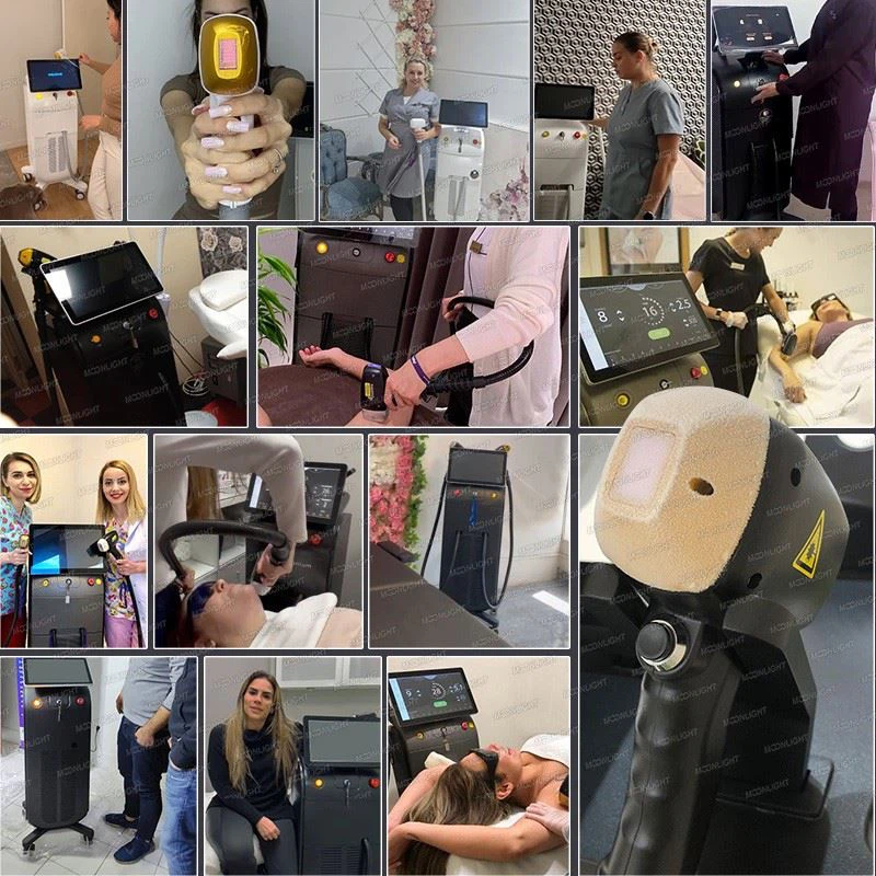 AI Intelligent System Hair Removal Machine