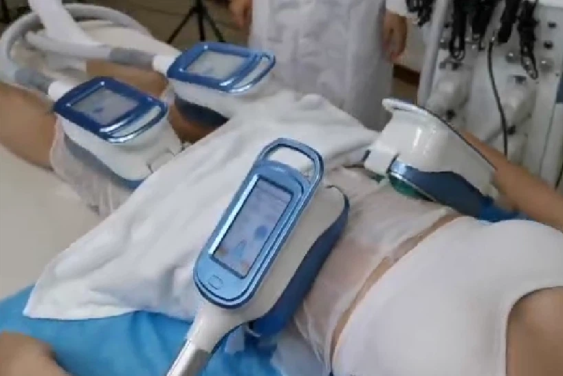 Best Cryolipolysis Antifreeze Membranes